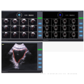 Blase Ultraschallscanner drahtlos